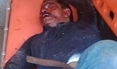 सड़क हादसे में मोले खान गम्भीर, डॉक्टर्स ने किया जबलपुर रेफर