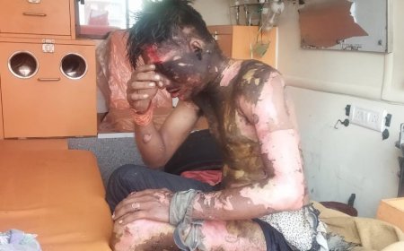 बिजली की चपेट में युवक गम्भीर, जबलपुर रेफर