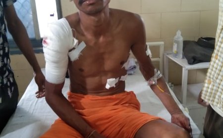 महुआ बीन रहे ग्रामीण पर बाघ ने किया हमला
