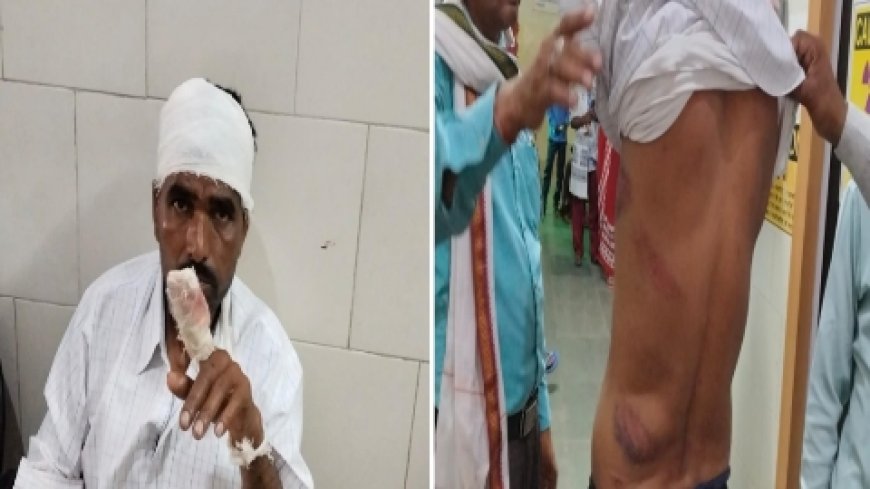 जमीनी विवाद में कुल्हाड़ी से हमला, दंपत्ति गंभीर रूप से घायल