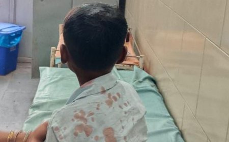 बड़ी खबर : स्कूल की छत का प्लास्टर गिरा, सात वर्षीय छात्र घायल