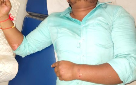मम्मी की राखी लेकर मामा के घर जा रहे भाई-बहन हादसे में घायल