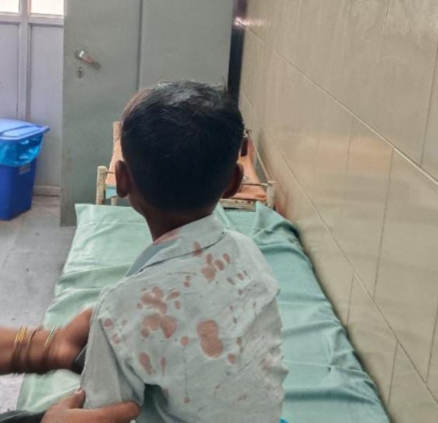 बड़ी खबर : स्कूल की छत का प्लास्टर गिरा, सात वर्षीय छात्र घायल